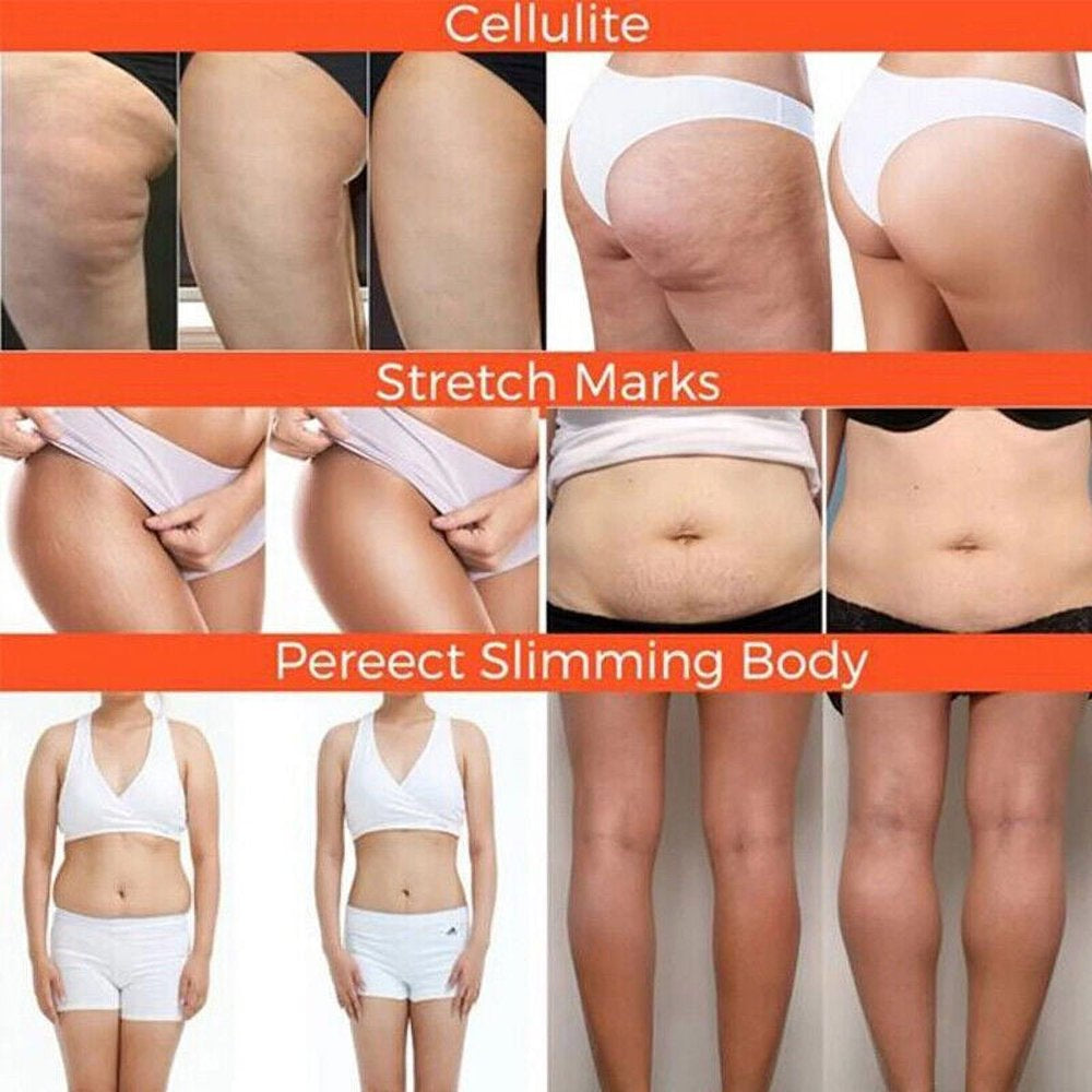 A6BURN Weight Loss Capsules Fat Burner Supplement DIET CAPSULES for Men Women 120 Capsules