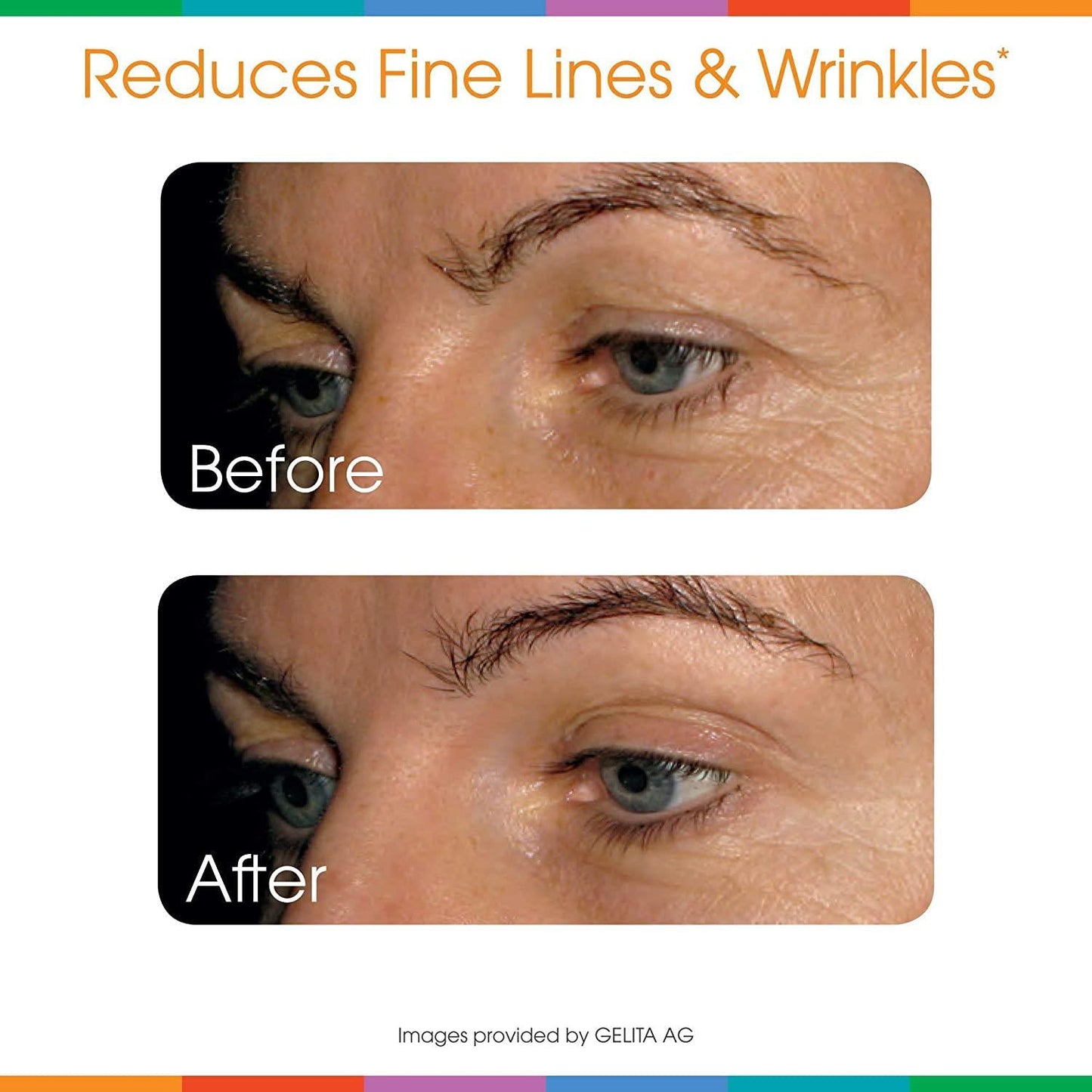 Sparkle Skin Boost Plus Verisol Collagen Peptides Protein Powder Vitamin C Orange Plus Supplement Drink, 8.1 oz