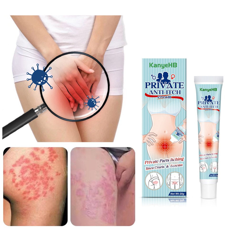AURORA TRADE 20G Vaginal Cream Non-Irritating Anti-Itch Harmless Gynecological Herb Plaster Private Parts Cream Personal Care Products