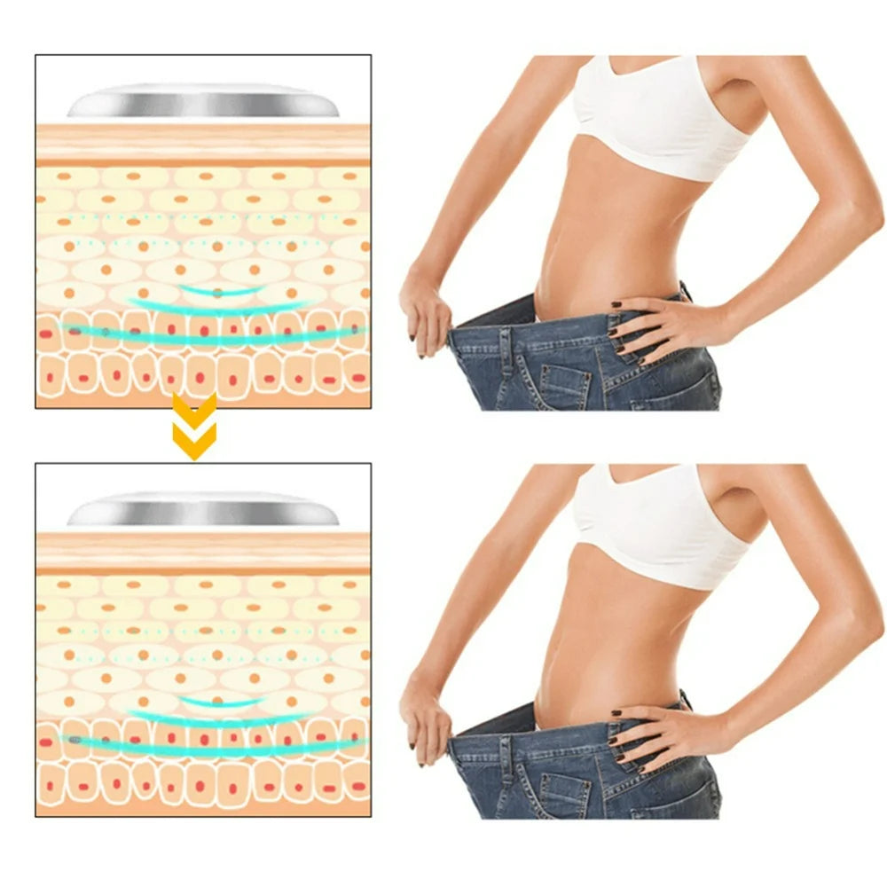 CHAMAIR VE Sport Liposuction Machine Belly Arm Weight Loss Body Shaping Slimming