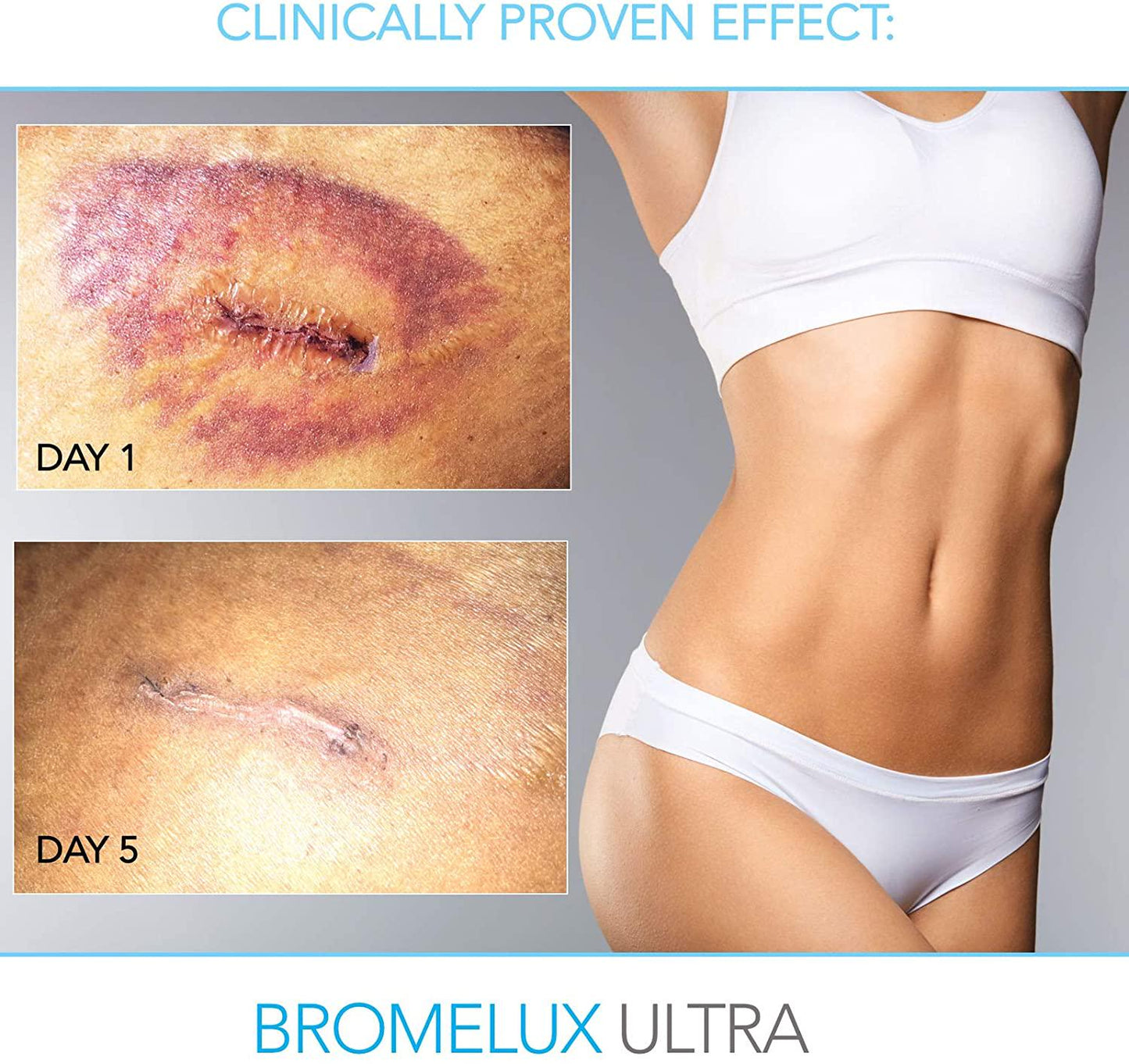 BROMELUXE ULTRA Anti-Bruising Supplement I Bromelain and Quercetin with Turmeric and Boswellia: Swelling and Bruise Relief, Anti-Inflammatory Treatment I For Recovery After Surgery and Trauma I 120 Caps
