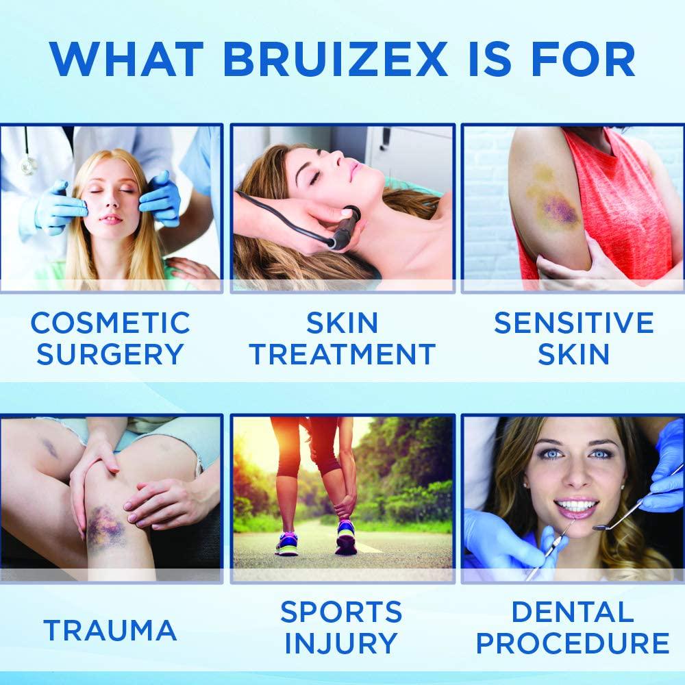 BRUIZEX Ultra Bruising Relief Supplement, 120 Capsules | Swelling Surgery Supplements for Bruised Skin and Trauma Recovery | Contains Bromelain, Quercetin, Turmeric and Boswellia