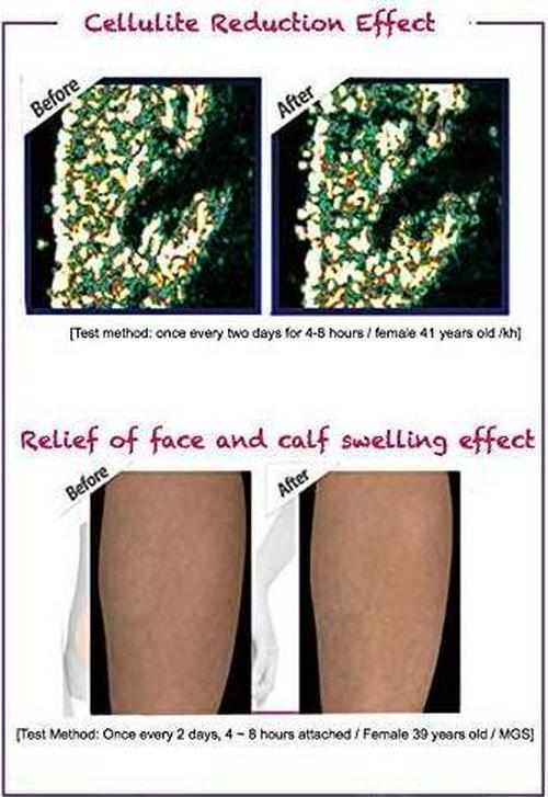 EZONEDEAL 5 Pcs Wonder Patch Quick Slimming Patch Belly Slim Patch Abdomen Slimming Fat Burning Navel Stick for Women and Men Use