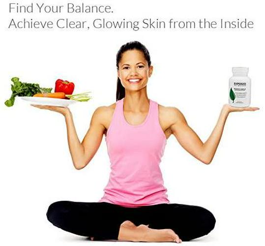 Exposed Skin Care Probiotic Complex - Skin Balancing Dietary Supplements, Assist Your Skin Care Routine with a Healthy Immune System, 60 ct Capsules