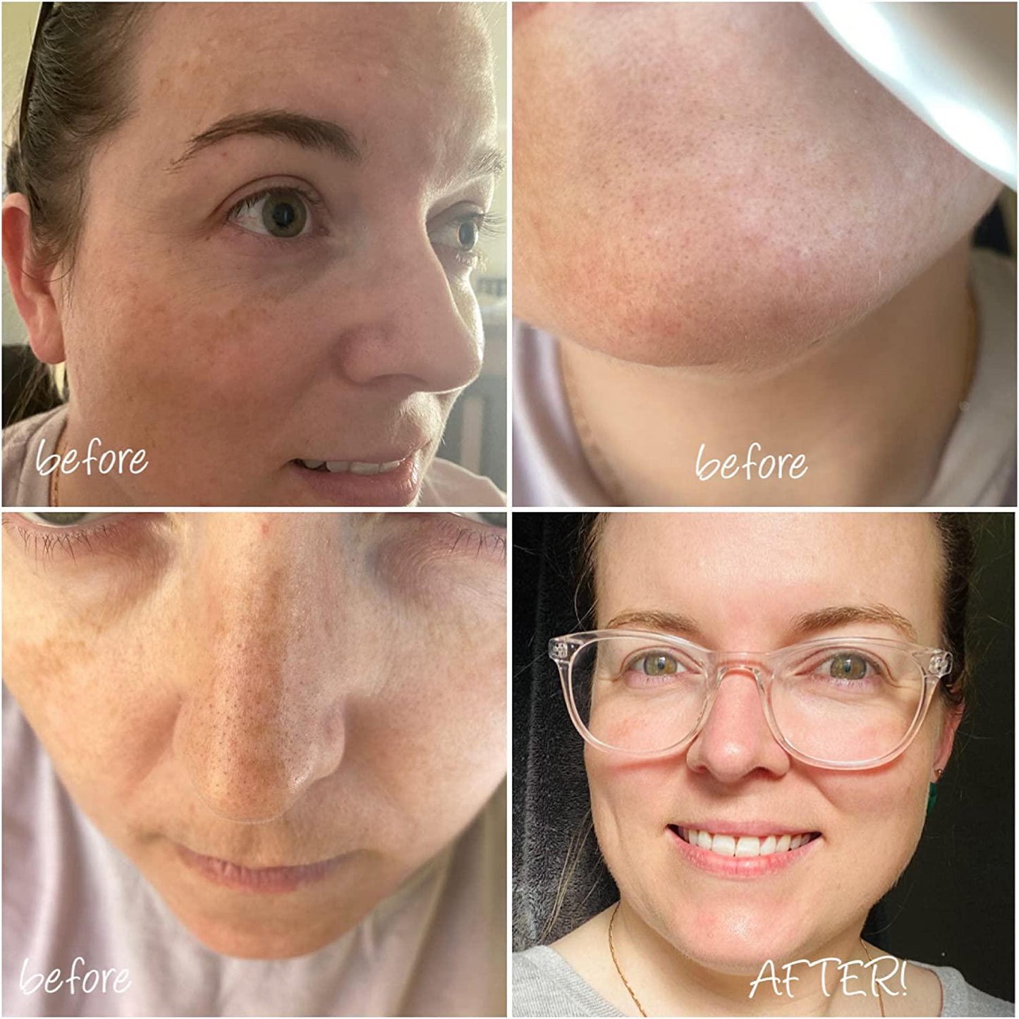 Glow Proteins Glow Elixir Premium Marine Collagen Powder 125 grams | 50 Servings