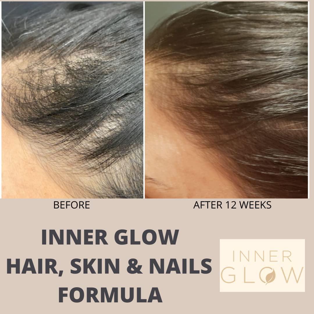 Inner Glow Advanced Hair, Skin and Nails Formula