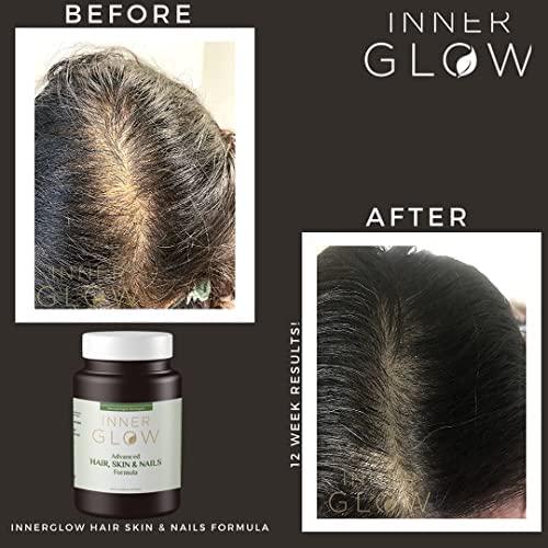 Inner Glow Advanced Hair, Skin and Nails Formula