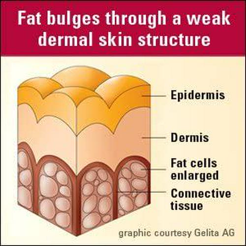 Lindberg Skin Rejuvenator With Verisol, 90 Tablets, Bioactive Collagen Peptides