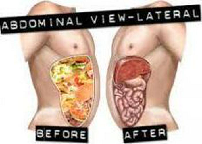 Miracle Oxy-Cleanse 120 Vegetarian Capsules Colon Cleanser