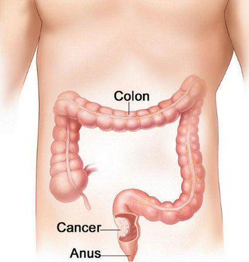 Miracle Oxy-Cleanse 120 Vegetarian Capsules Colon Cleanser