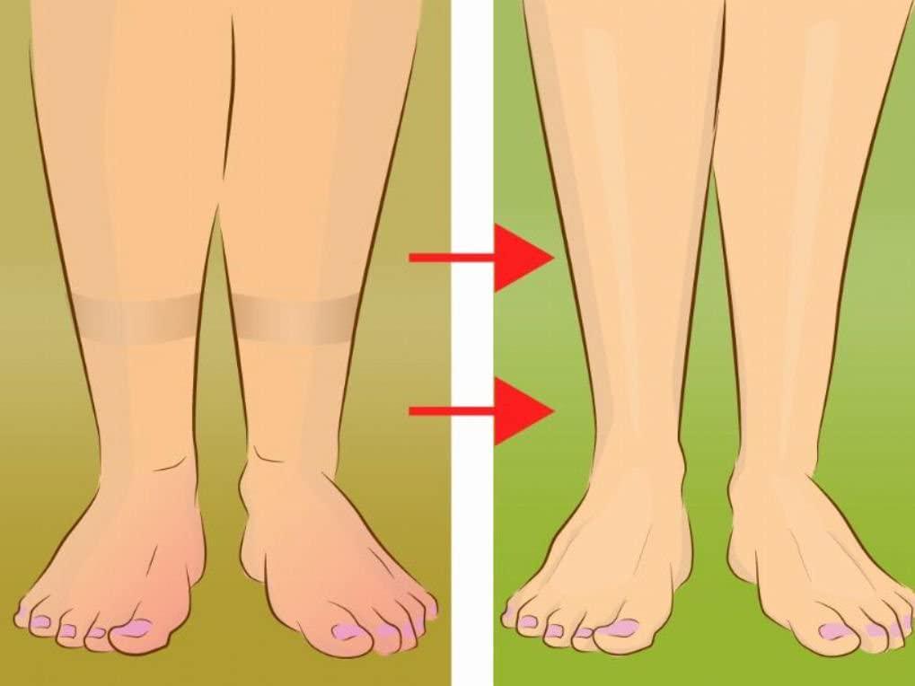 Natural Diuretic Water Pill Guaranteed to Eliminate Water Retention