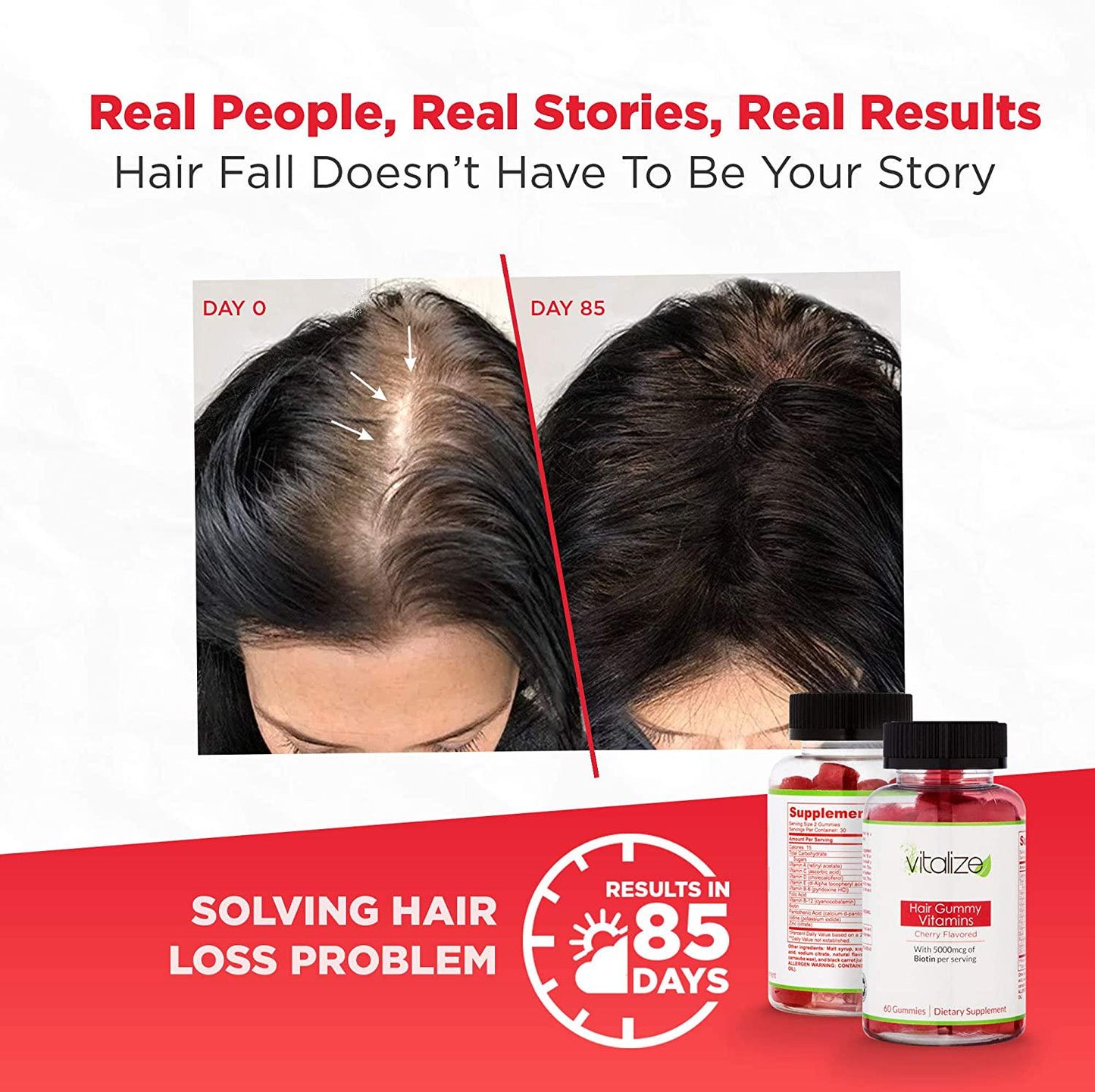 Vitalize Multivitamin Hair Gummy