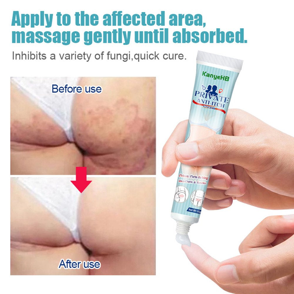 AURORA TRADE 20G Vaginal Cream Non-Irritating Anti-Itch Harmless Gynecological Herb Plaster Private Parts Cream Personal Care Products