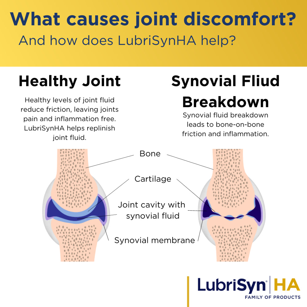 Lubrisyn HA Original Unflavored Liquid Joint Supplement Made in USA for Human Use: Proprietary Vegan Formula to Promote Joint Health and Advanced Support for Optimal Joint Health - 30 Day Supply