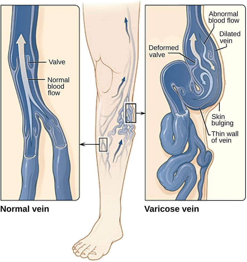 Varicose Vein Treatment Leg Circulation Supplement Diosmin Leg Vein Support - 90 Capsules