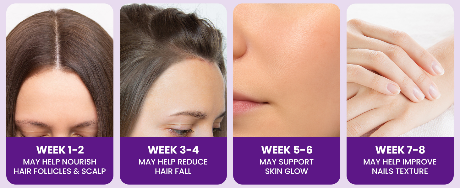 Carbamide Forte Biotin Tablets for Hair Growth | Biotin Supplement with Amla, Brahmi & Bamboo Extract | Hair Vitamins | Biotin Multivitamin for Hair & Skin | Hair Supplements for Women & Men | 90 Veg Tablets