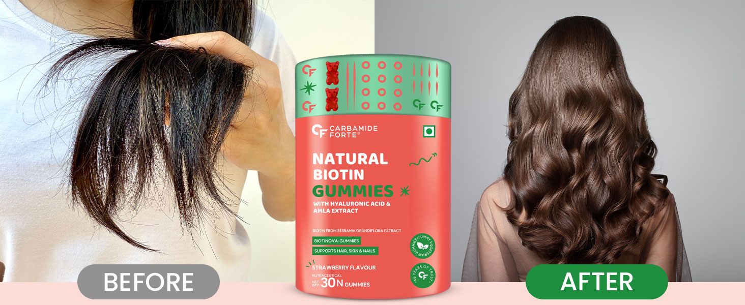 Carbamide Forte Biotin Gummies for Hair Growth | Supplement for Men & Women | - 30 Veg Strawberry - Flavored Gummies