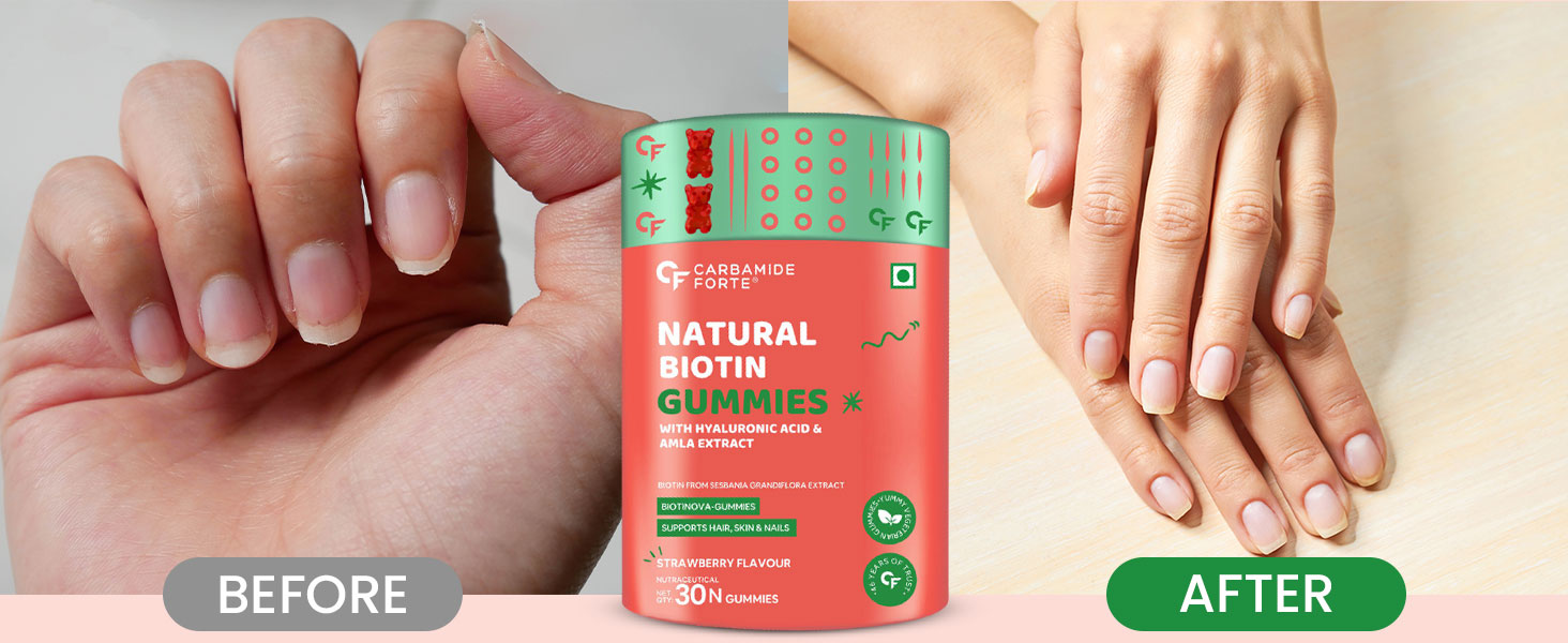 Carbamide Forte Biotin Gummies for Hair Growth | Supplement for Men & Women | - 30 Veg Strawberry - Flavored Gummies