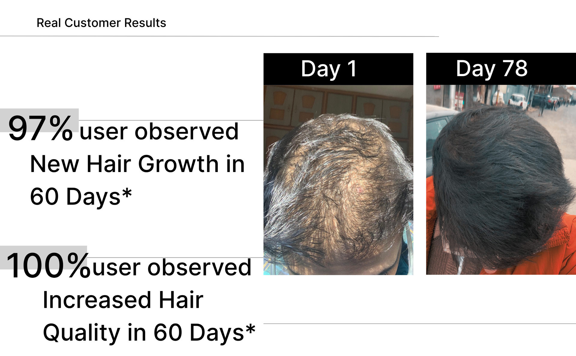 Hair Growth Biotin Tablets | Biotin Tablets with Multivitamin Ingredients