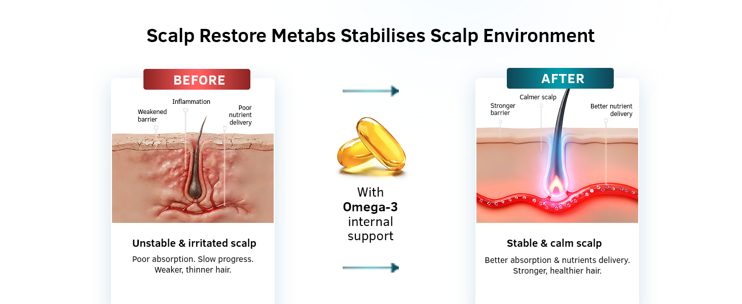 Ustraa Scalp Restore Metabs | Flax Seed Oil 500 mg | Omega-3s | 30 Softgels
