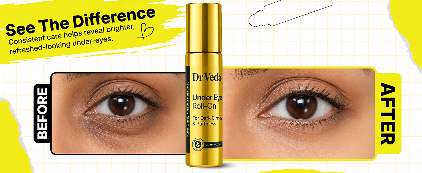 Under Eye Roll-On for Dark Circles Removal, Puffiness & Fine Lines | Under Eye Cream with Cooling, Brightening & Hydrating Formula | Anti-Wrinkle | For Men & Women | 10 ml
