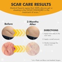 pure-scar-care-medical-grade-silicone-ge-3.jpg