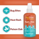 skinsmart-antimicrobial-rash-and-hive-ca-3.jpg