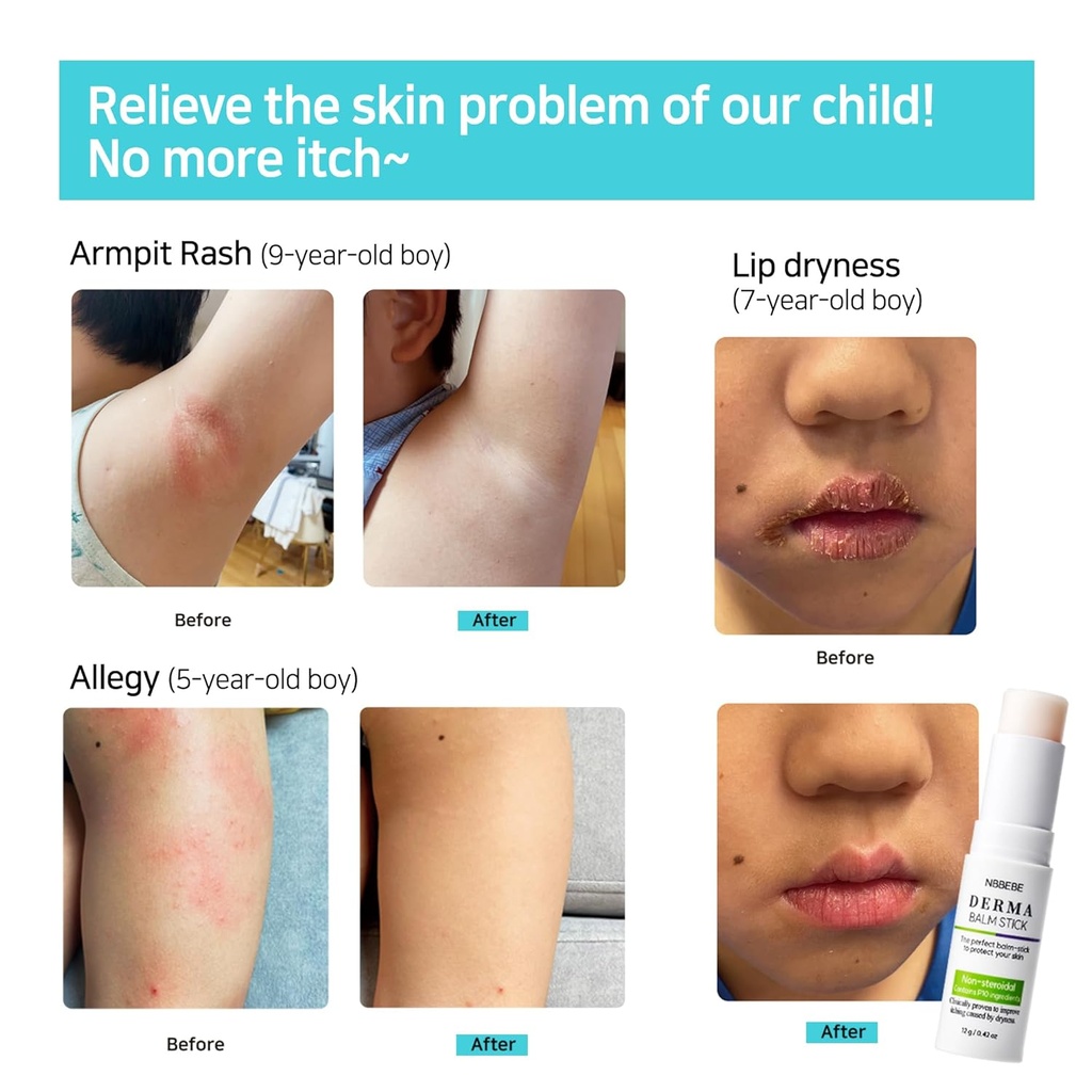 korea-derma-anti-itch-moisturizer-multi--6.jpg