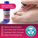 better-nail---treatment-for-fungus-under-6.jpg