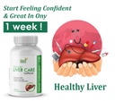 yash-herbal-herbal-liver-care-capsule-30-617HGXl7NTL.jpg