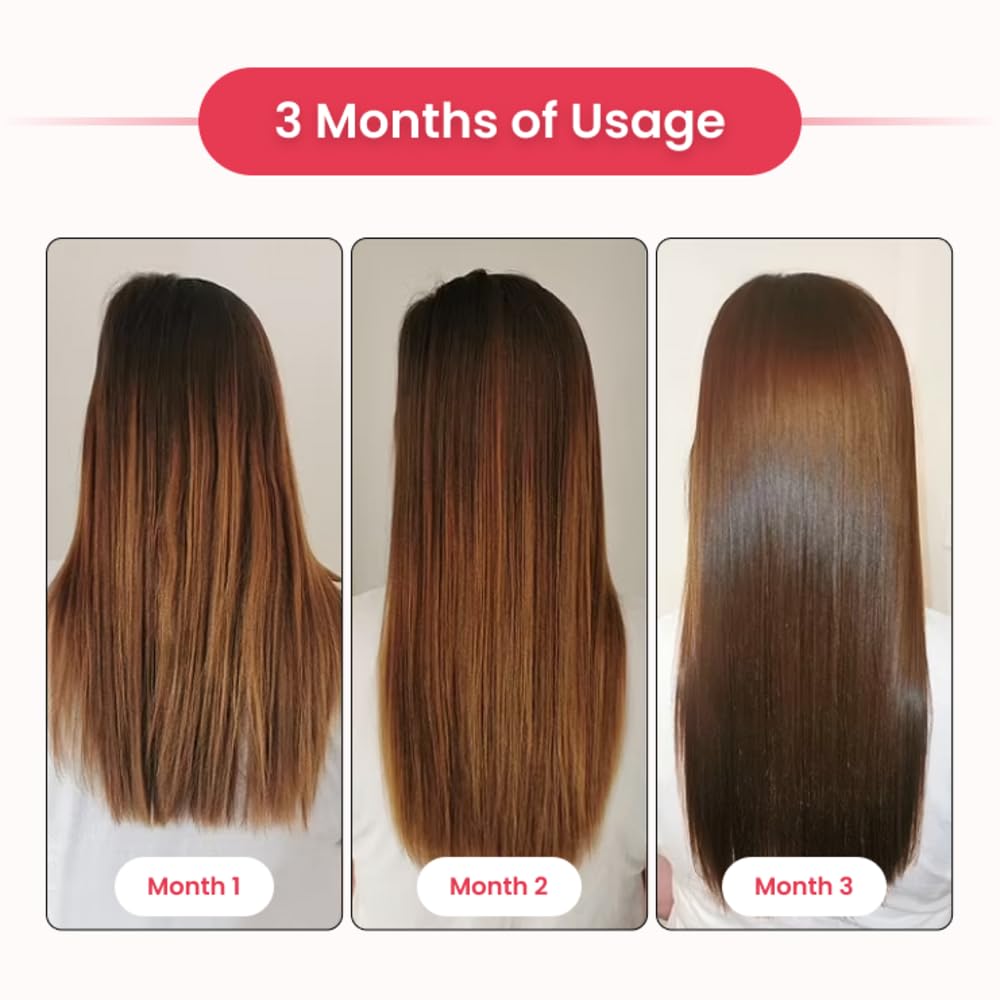 hair-biotin-oral-spray-25ml-pack-of-1-bi-61PCV1DS3YL.jpg