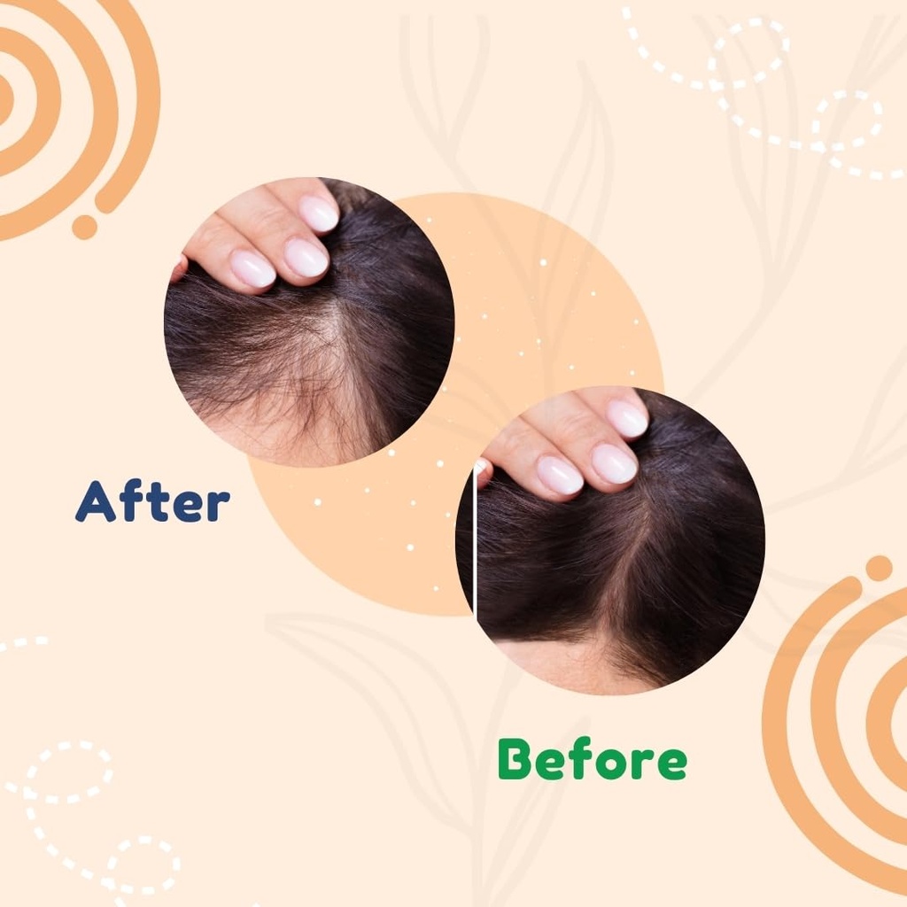 hair-biotin-tablets-with-grape-seed-extr-51jRwbe9KjL.jpg
