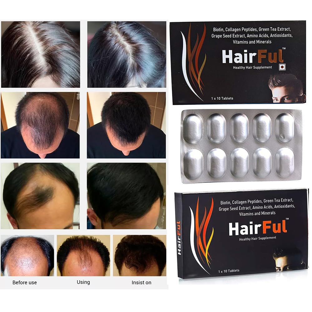 hairful-biotin-supplement-tablet-for-hel-61ylAs4l+AL.jpg