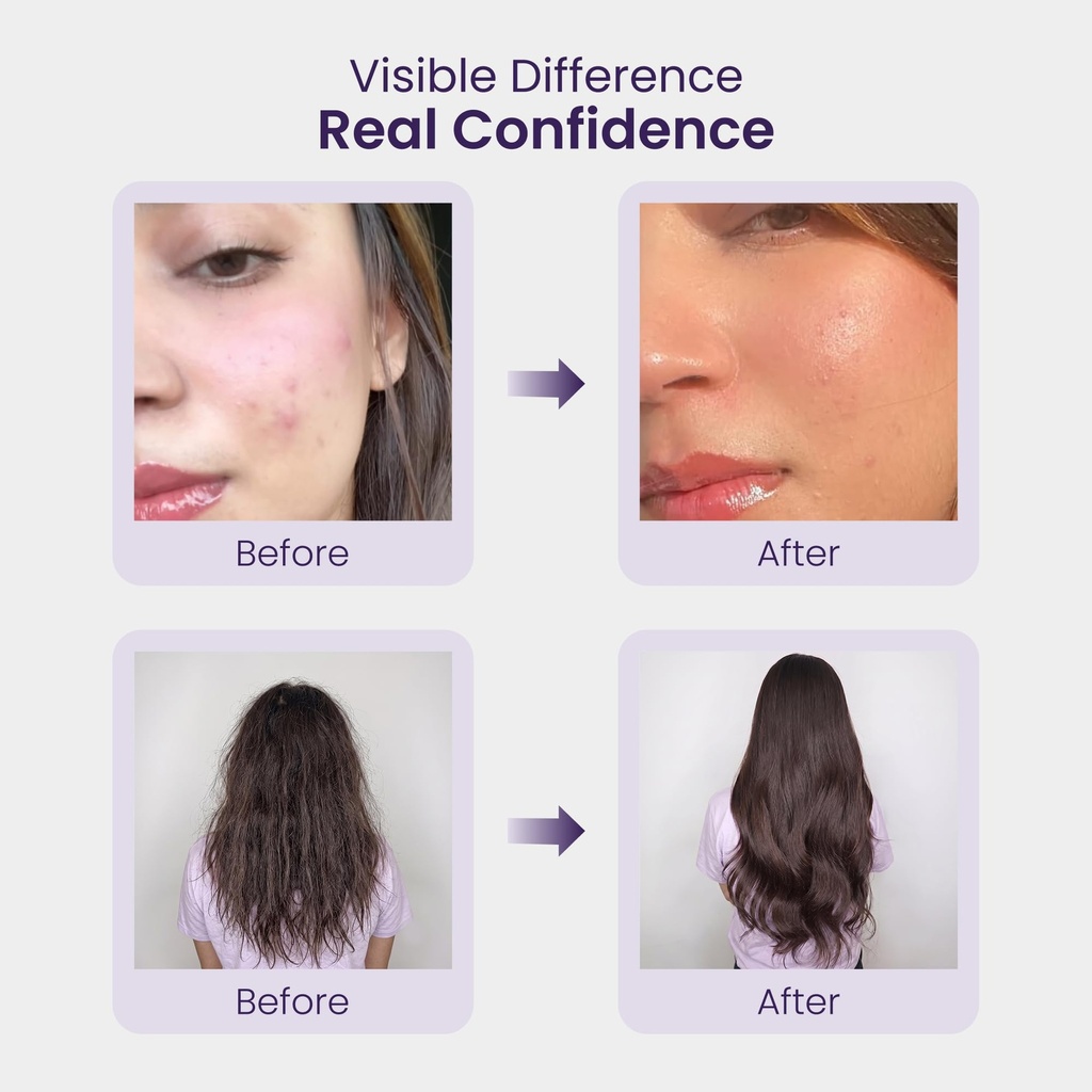 biotin-hair-nail-skin-gummies-grape-flav-71pPOsTSy-L.jpg