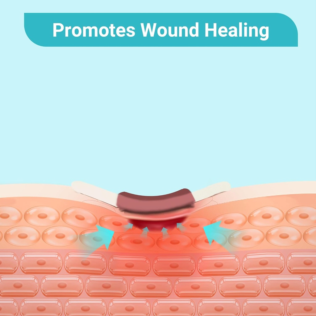 conkote-silver-alginate-wound-dressing-p-5.jpg