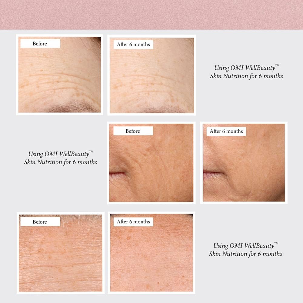 omi-wellbeauty-skin-nutrition-clinically-4.jpg