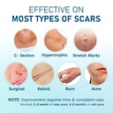 silicone-scar-sheets-10pcs-silicone-tape-5.jpg