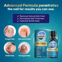 toenail-fungus-treatment-extra-strength--2.jpg
