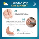 toenail-fungus-treatment-extra-strength--6.jpg