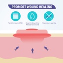 conkote-hydrocolloid-wound-dressing-4x-4-3.jpg