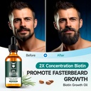 sandalwood-beard-growth-kit-with-2x-biot-6.jpg