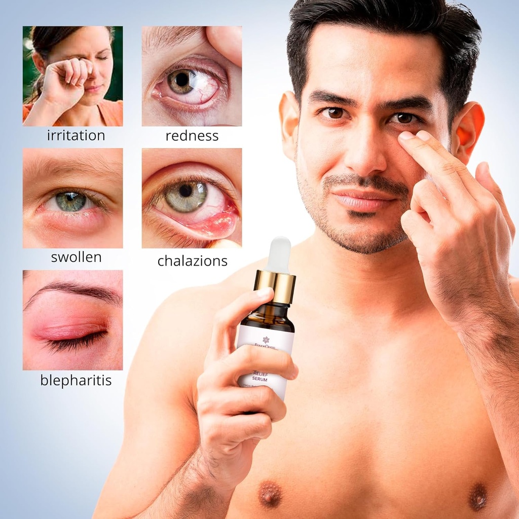 roycederm-stye-eye-treatment-serum-natur-5.jpg