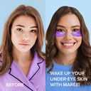 maree-eye-gels-acne-сlearing-devices-bun-4.jpg