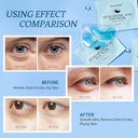 under-eye-patchs-hyaluronic-acid-eye-mas-4.jpg