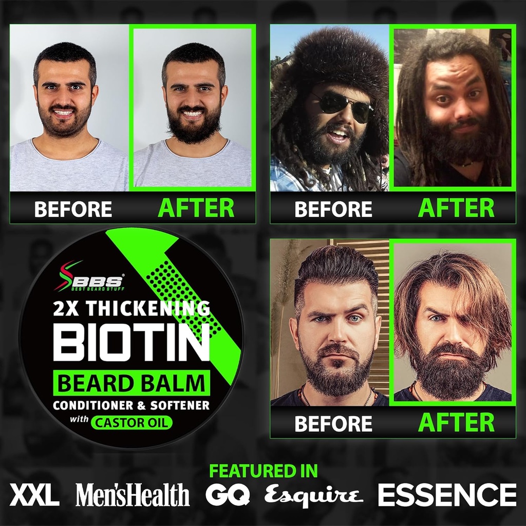 beard-growth-kit-w-2x-biotin-beard-balm--3.jpg