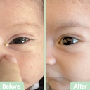 glambaby-eye-care---eye-boogiesTM-eyelid-2.jpg