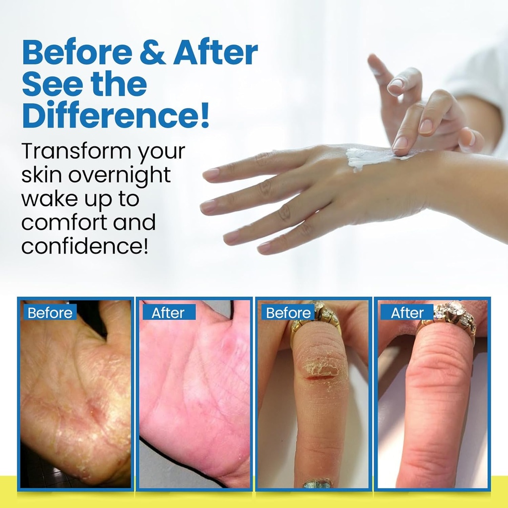 dermasolve-full-body-eczema-relief-lotio-3.jpg