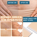 silicone-scar-sheets-2-rolls-medical-gra-4.jpg