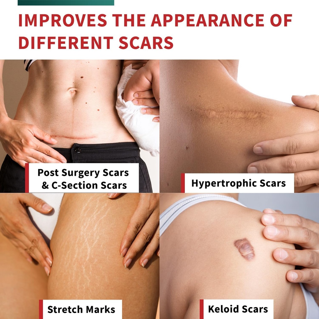 protect-life-silicone-scar-sheets-16-x-1-6.jpg