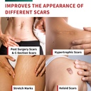 protect-life-silicone-scar-sheets-16-x-1-6.jpg